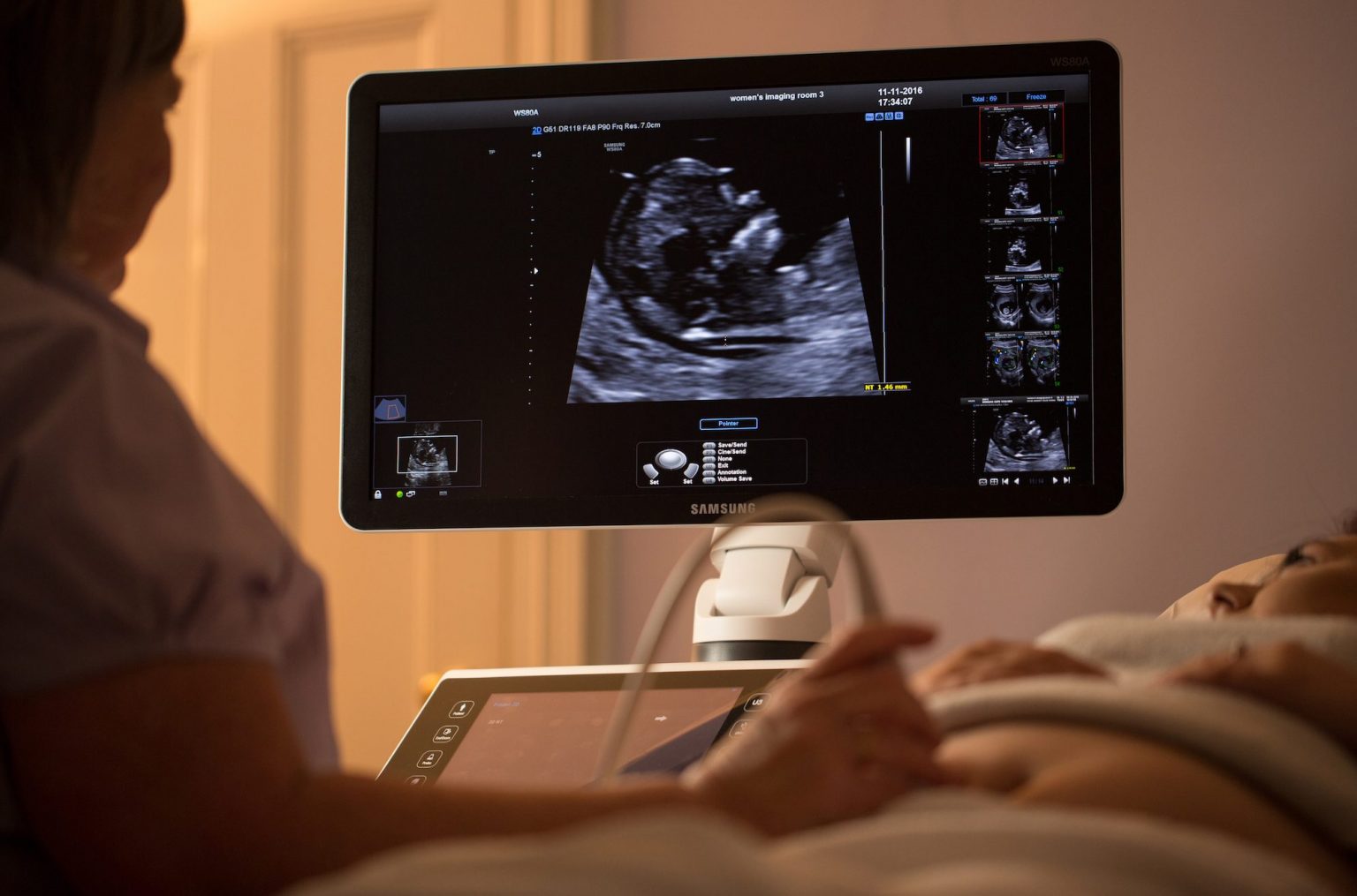 When Do You Have Your First Ultrasound? [2024]